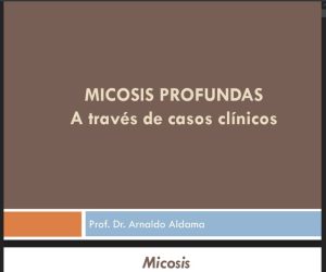 Micosis Profunda